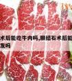 胆结石术后能吃牛肉吗,胆结石术后能吃牛肉吗会复发吗