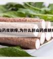 山药皮肤痒,为什么刮山药皮肤痒