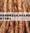 削完山药皮皮肤痒怎么办,为什么削完山药皮肤瘙痒吃了没事儿